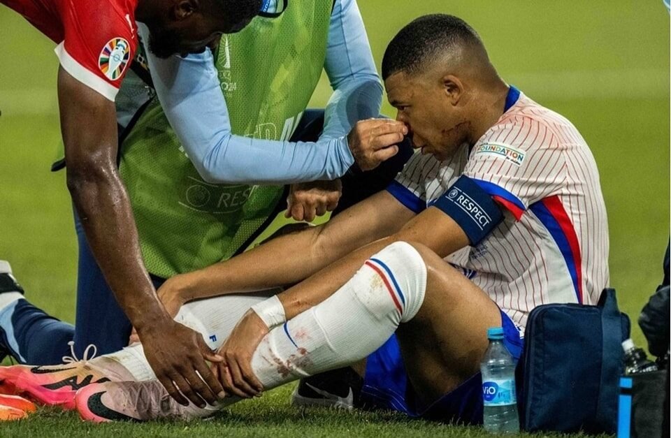 France : Évaluations et réactions officielles après la blessure de Kylian Mbappé